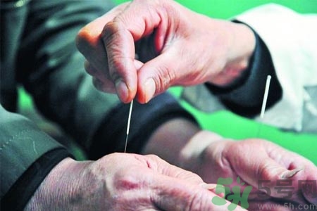 針灸一次要扎多長(zhǎng)時(shí)間？針灸可以幾天做一次？