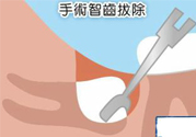 智齒拔完后有個(gè)洞怎么辦？拔智齒后有個(gè)洞多久能長(zhǎng)好？
