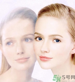 曬斑可以自己消退嗎？曬斑可以用激光去除嗎？