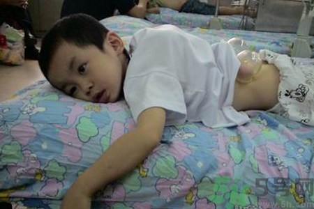 小孩可以拔罐嗎？寶寶能拔火罐嗎？