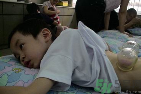 小孩可以拔罐嗎？寶寶能拔火罐嗎？