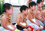 小孩可以拔罐嗎？寶寶能拔火罐嗎？