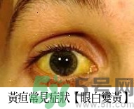 上腹部不舒服有時疼痛會不會是胰臟癌？