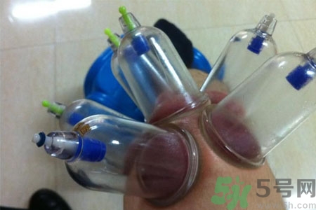 膝蓋能拔罐嗎？膝蓋疼可以拔罐嗎？