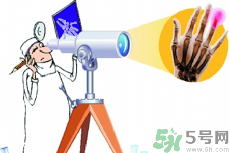 什么年齡測(cè)骨齡最好？如何測(cè)骨齡？