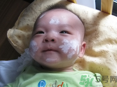 新生兒濕疹可以用爐甘石洗劑嗎？新生兒濕疹的護(hù)理措施