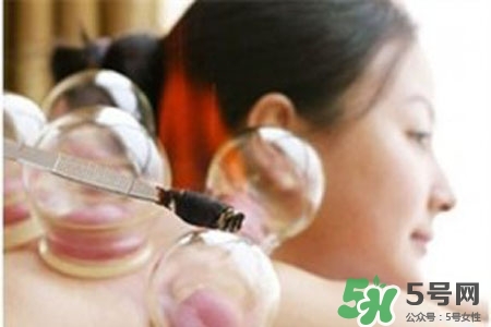 拔罐放血對(duì)身體好嗎？拔罐放血有什么好處？