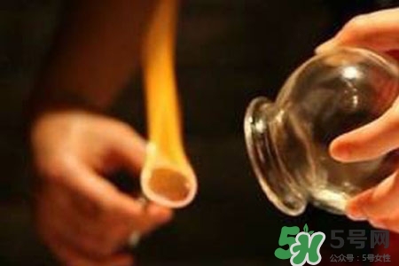 拔罐放血對(duì)身體好嗎？拔罐放血有什么好處？
