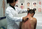 刮痧后什么顏色才健康？刮痧顏色反映的病癥