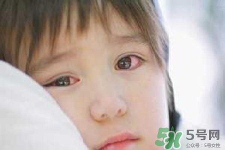孩子為什么老眨眼睛？孩子總眨眼睛怎么回事？