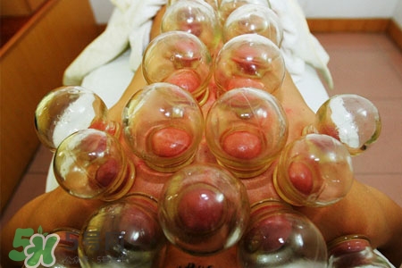 拔罐后皮膚發(fā)癢是怎么回事？拔罐后為什么皮膚會(huì)癢？