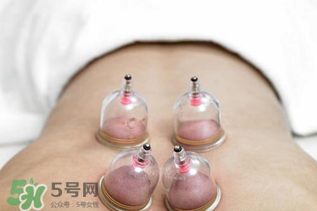 冬天拔罐好還是刮痧好？冬天刮痧和拔罐哪個(gè)效果好？