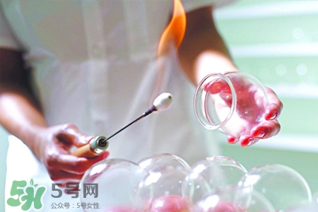 冬天拔罐后多久能洗澡？警惕冬季拔罐后不宜立即洗澡
