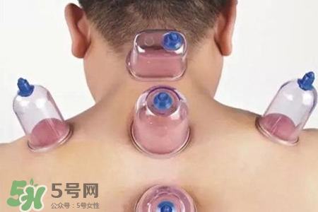 拔罐后可以喝酒嗎？拔罐后多久能喝酒？