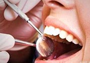 拔牙之后可以吃藥嗎？拔牙之后要不要吃藥？