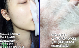 稚優(yōu)泉面膜怎么用？稚優(yōu)泉面膜要洗嗎？
