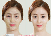 skin1004是什么牌子？skin1004屬于什么檔次