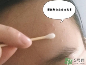 星期四農(nóng)莊茶樹(shù)精油怎么用？星期四農(nóng)莊茶樹(shù)精油使用方法
