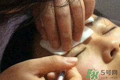 埋線雙眼皮需要拆線嗎？埋線雙眼皮怎么拆線