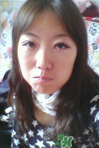 什么是定點(diǎn)雙眼皮？定點(diǎn)雙眼皮多少錢(qián)？
