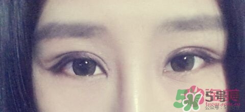 切開(kāi)雙眼皮多久消腫？切開(kāi)雙眼皮多久恢復(fù)？