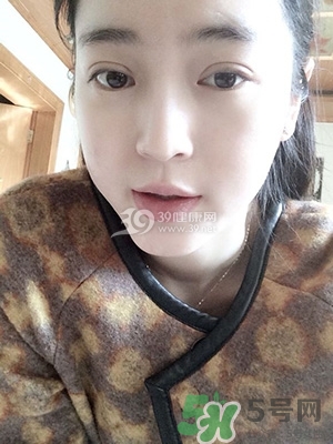 什么是定點(diǎn)雙眼皮？定點(diǎn)雙眼皮多少錢(qián)？