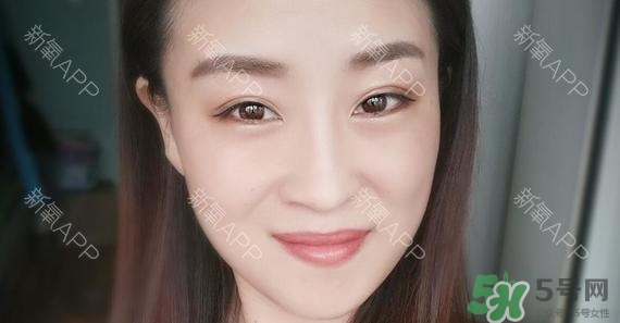 埋線雙眼皮能保持多久？埋線雙眼皮是永久嗎