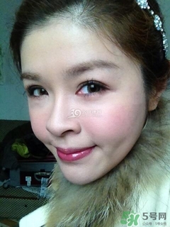重瞼術(shù)是什么？重瞼術(shù)是永久的嗎？
