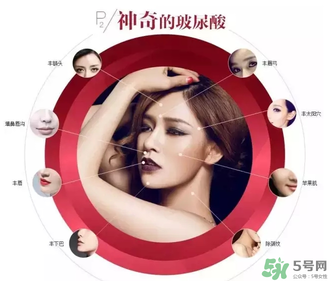 喬雅登是哪個國家的？喬雅登玻尿酸哪個國家？