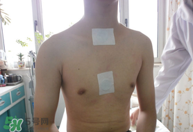 三九貼怎么貼？三九貼的貼法