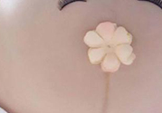 妊娠線每個(gè)孕婦都有嗎？妊娠線出現(xiàn)的時(shí)間