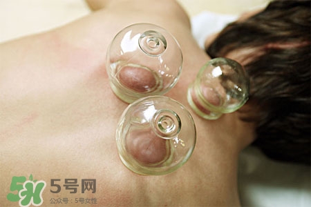 拔罐放血會(huì)得傳染病么？拔罐放血會(huì)傳染疾病嗎？