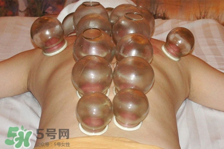 拔罐分季節(jié)嗎？不同季節(jié)的拔罐禁忌