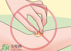 水泡怎么處理？水泡要不要刺破？