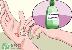 水泡怎么處理？水泡要不要刺破？
