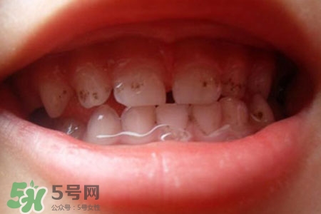 刷牙后吃東西發(fā)苦正常嗎？為什么刷牙后吃東西發(fā)苦？