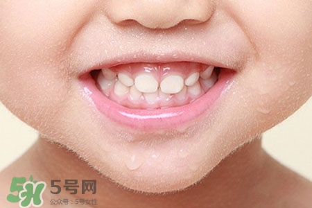 刷牙后吃東西發(fā)苦正常嗎？為什么刷牙后吃東西發(fā)苦？