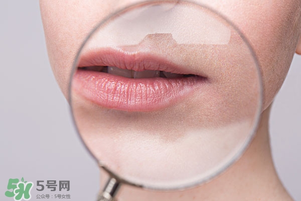 嘴唇起泡腫了怎么辦？嘴唇起泡腫了怎么消腫