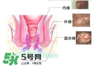 痔瘡吃什么藥效果好？痔瘡吃什么藥好得快？