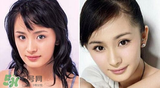 打瘦臉針能懷孕嗎？打瘦臉針能吃避孕藥嗎？
