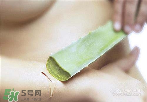 蘆薈涂在臉上發(fā)癢是怎么回事？蘆薈涂在臉上發(fā)癢怎么辦？