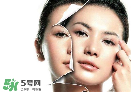 美白針是什么？美白針可以連續(xù)打嗎？