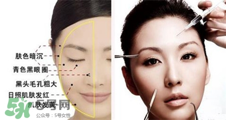 美白針的效果明顯嗎？美白針一個療程幾次？