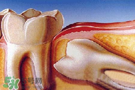 智齒會(huì)引起耳鳴嗎？耳鳴跟智齒有關(guān)系嗎？