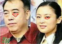 臥蠶是黑眼圈嗎？臥蠶和黑眼圈的區(qū)別
