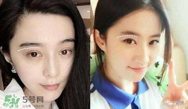 割雙眼皮有幾種做法？雙眼皮有哪幾種形狀？