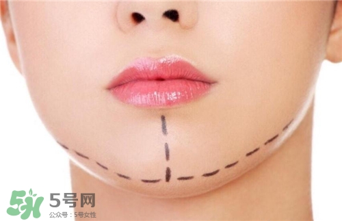 玻尿酸墊下巴能維持多久？玻尿酸墊下巴能維持多長(zhǎng)時(shí)間？