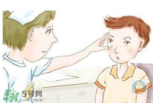 紅眼病用什么眼藥水好？紅眼病吃什么好得快