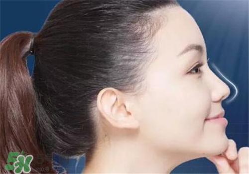 隆鼻會拉近眼距嗎？隆鼻會改變眼睛嗎？