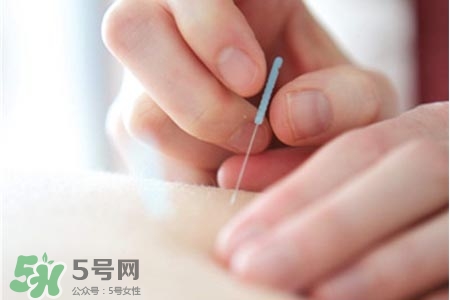 沒病可以針灸嗎？沒病可以扎針嗎？